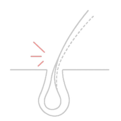 Thread Lifts